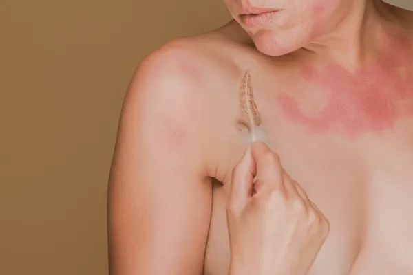 Eczema & Sensitive Skin
